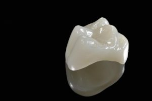 Dental crowns at Turners Falls Dental in Turners Falls, MA