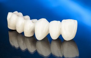 CEREC same-day crowns at Turners Falls Dental in Turners Falls, MA
